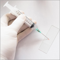 Five Cancer Tests on Lumps